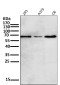 Anti-Phospho-Akt (Ser473) AKT1 Rabbit Monoclonal Antibody